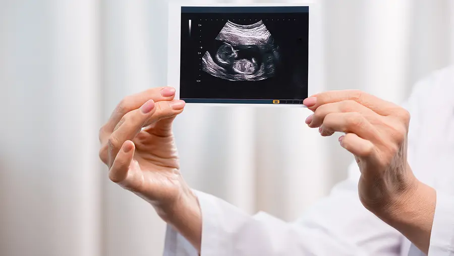 A person holding an image of a fetus.